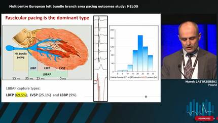Presentation thumbnail