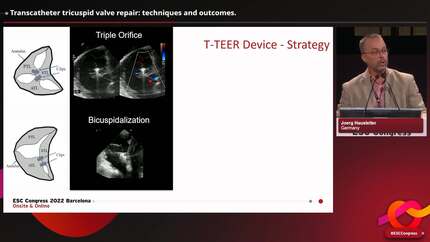 Presentation thumbnail