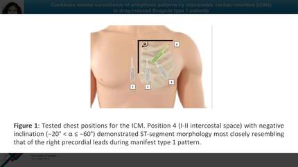 Presentation thumbnail