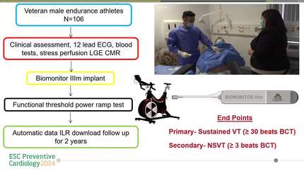 VENTricular arrhythmia and cardiac fibrOsis in endUrance eXperienced athletes (The VENTOUX Study)