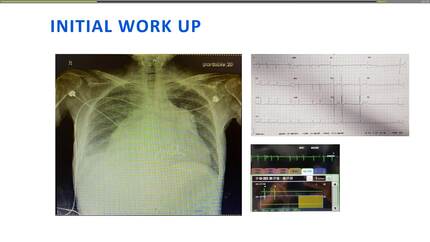 Presentation thumbnail