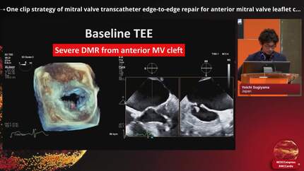 Presentation thumbnail