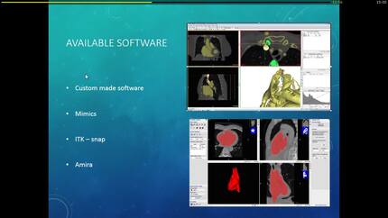 Presentation thumbnail