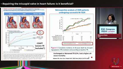 The right ventricle in heart failure: forget me not