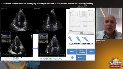The role of multimodality imaging in arrhythmic risk stratification of dilated cardiomyopathy.
