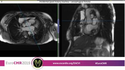 What a clinician needs to know about extracardiac findings.