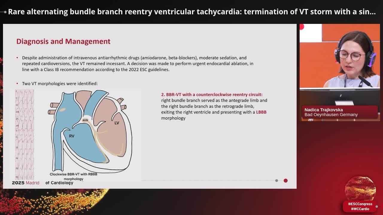 Ventricular arrhythmias in complex situations