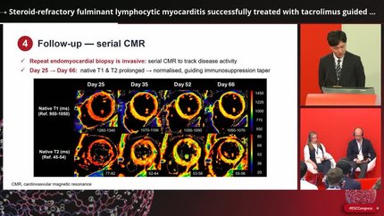 Steroid-refractory fulminant lymphocytic myocarditis successfully treated with tacrolimus guided by serial cardiovascular magnetic resonance