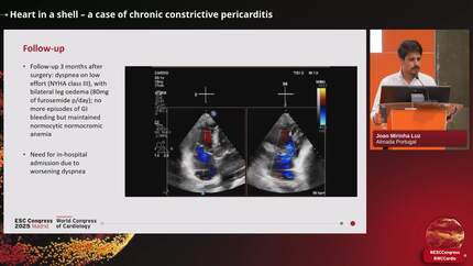 Heart in a shell – a case of chronic constrictive pericarditis