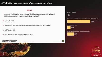 Management of ventricular arrhythmias