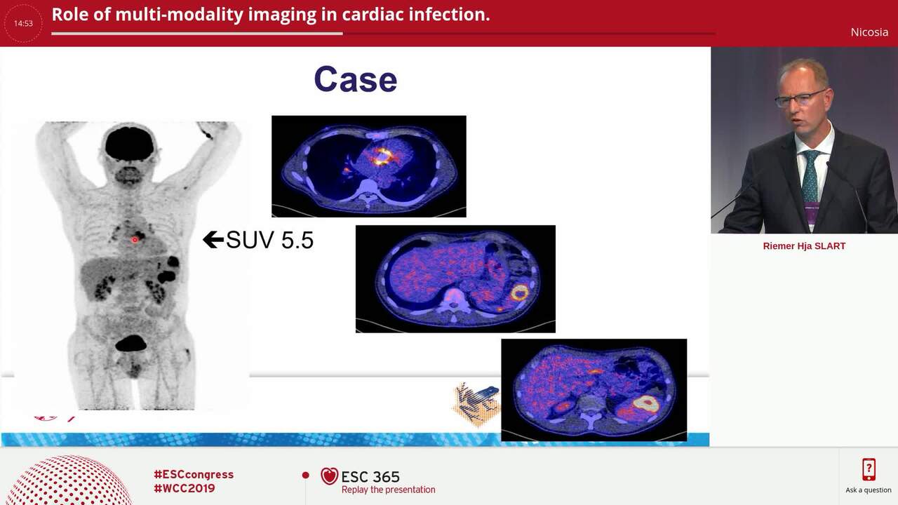 Role of multi-modality imaging in cardiac infection.