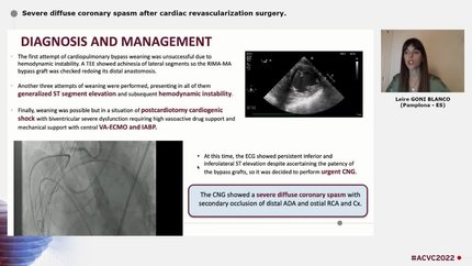 Severe diffuse coronary spasm after cardiac revascularization surgery.