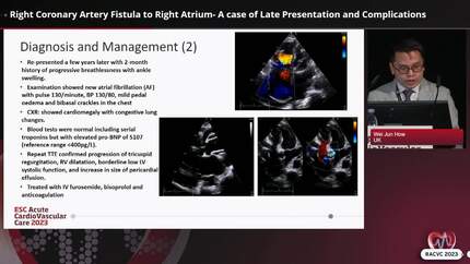 Right Coronary Artery Fistula to Right Atrium- A case of Late Presentation and Complications
