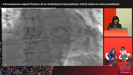 Presentation thumbnail