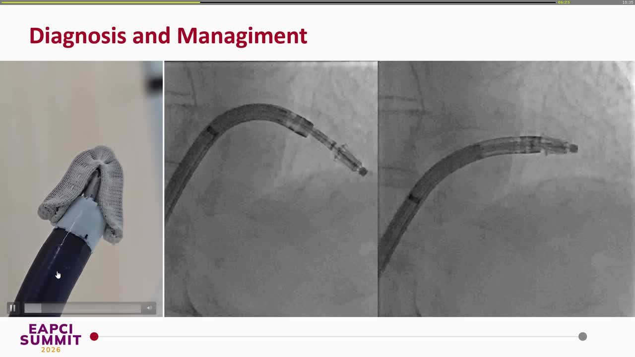 Bailout retrieval and reimplantation of a PASCAL ACE after intra-procedural SLDA in degenerative MR