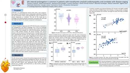 QTc prolongation is highly prevalent in patients with transthyretin cardiac amyloidosis and is associated with more advanced disease