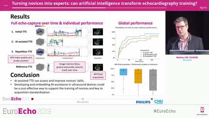 Turning novices into experts: can artificial intelligence transform echocardiography training?