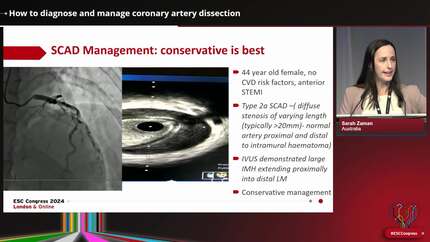 How to diagnose and manage uncommon causes of myocardial infarction