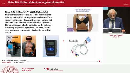 Atrial fibrillation detection in general practice.