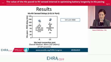 The value of the His paced to RV sensed interval in optimising battery longevity in His pacing