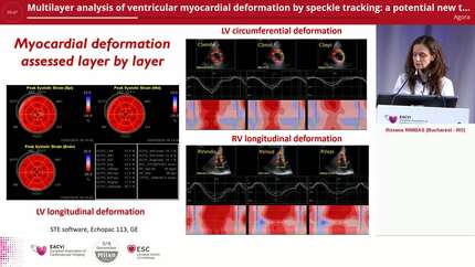 Multilayer analysis of ventricular myocardial deformation by speckle tracking: a potential new tool for a better characterization of heart failure continuum