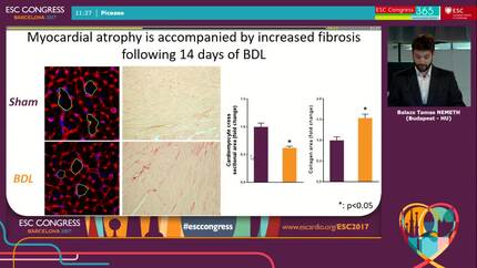 Characterization of a novel mouse model of hepatic cardiomyopathy.