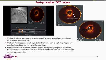 Presentation thumbnail