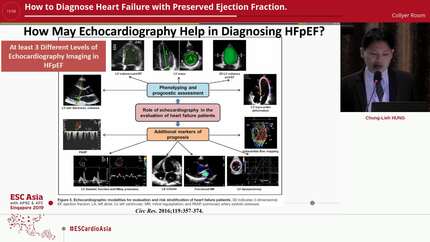How to Diagnose Heart Failure with Preserved Ejection Fraction.