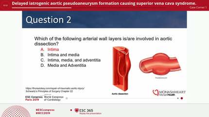 Delayed iatrogenic aortic pseudoaneurysm formation causing superior vena cava syndrome.