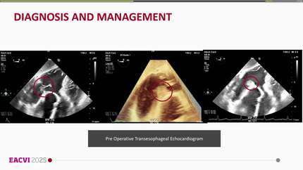 Presentation thumbnail