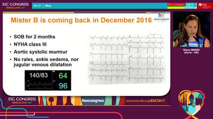 Left ventricular hypertrophy: daily traps