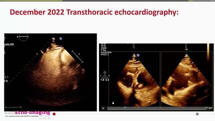 Presentation thumbnail