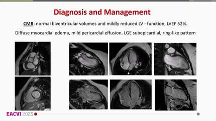 Presentation thumbnail