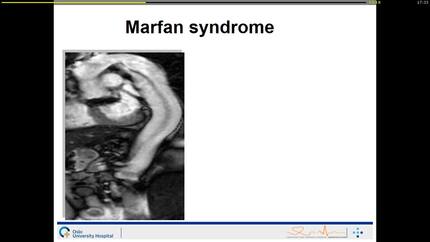Presentation thumbnail