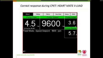 After LVAD implantation.