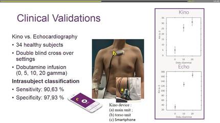 EHRA Inventor Award: KINO-cardiograph.