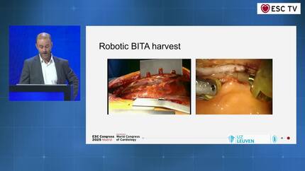 Introduction to minimally invasive surgical revascularisation