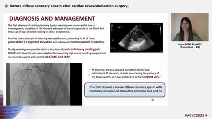 Severe diffuse coronary spasm after cardiac revascularization surgery.