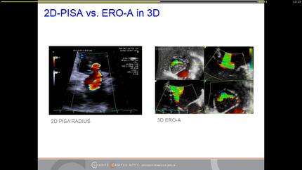 Presentation thumbnail