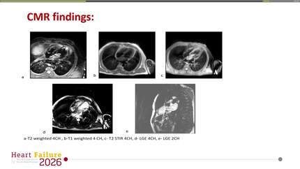 Presentation thumbnail