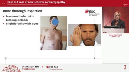 Presentation thumbnail