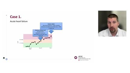 Artificial intelligence in intensive and acute cardiovascular care