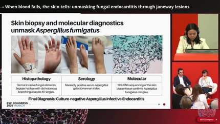 When blood fails, the skin tells: unmasking fungal endocarditis through janeway lesions