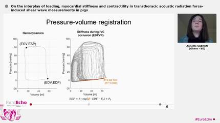 On the interplay of loading, myocardial stiffness and contractility in transthoracic acoustic radiation force-induced shear wave measurements in pigs
