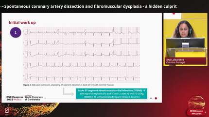 Unmasking SCAD: challenges in diagnosing and managing spontaneous coronary artery dissection