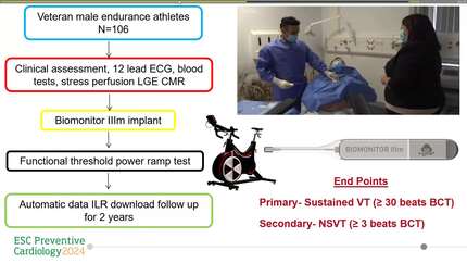 VENTricular arrhythmia and cardiac fibrOsis in endUrance eXperienced athletes (The VENTOUX Study)