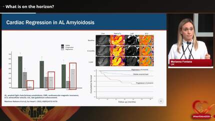 How to manage cardiac amyloidosis