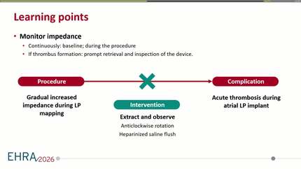 Acute thrombosis during atrial leadless pacemaker implantation: a rare case report