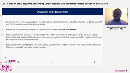 A case of atrial myxoma presenting with dyspnoea and abnormal cardiac border on chest x-ray.