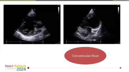 Presentation thumbnail